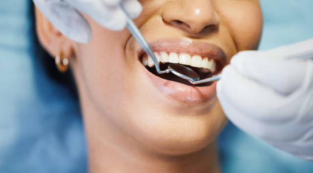 Teeth Whitening in VA